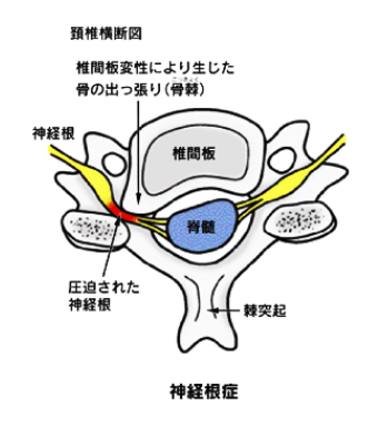 頚椎横断図