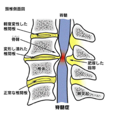 頚椎側面図