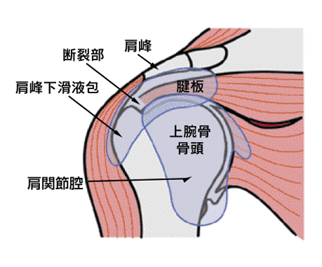 肩腱板