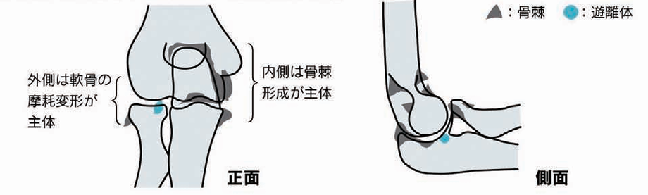 肘の関節